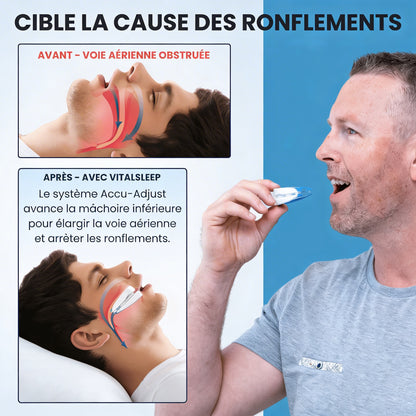 Dentier buccal anti-ronflement silencieux